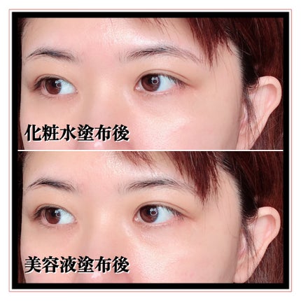 シカテロル スポットマスクパッド/beplain/トナーパッドを使ったクチコミ(5枚目)