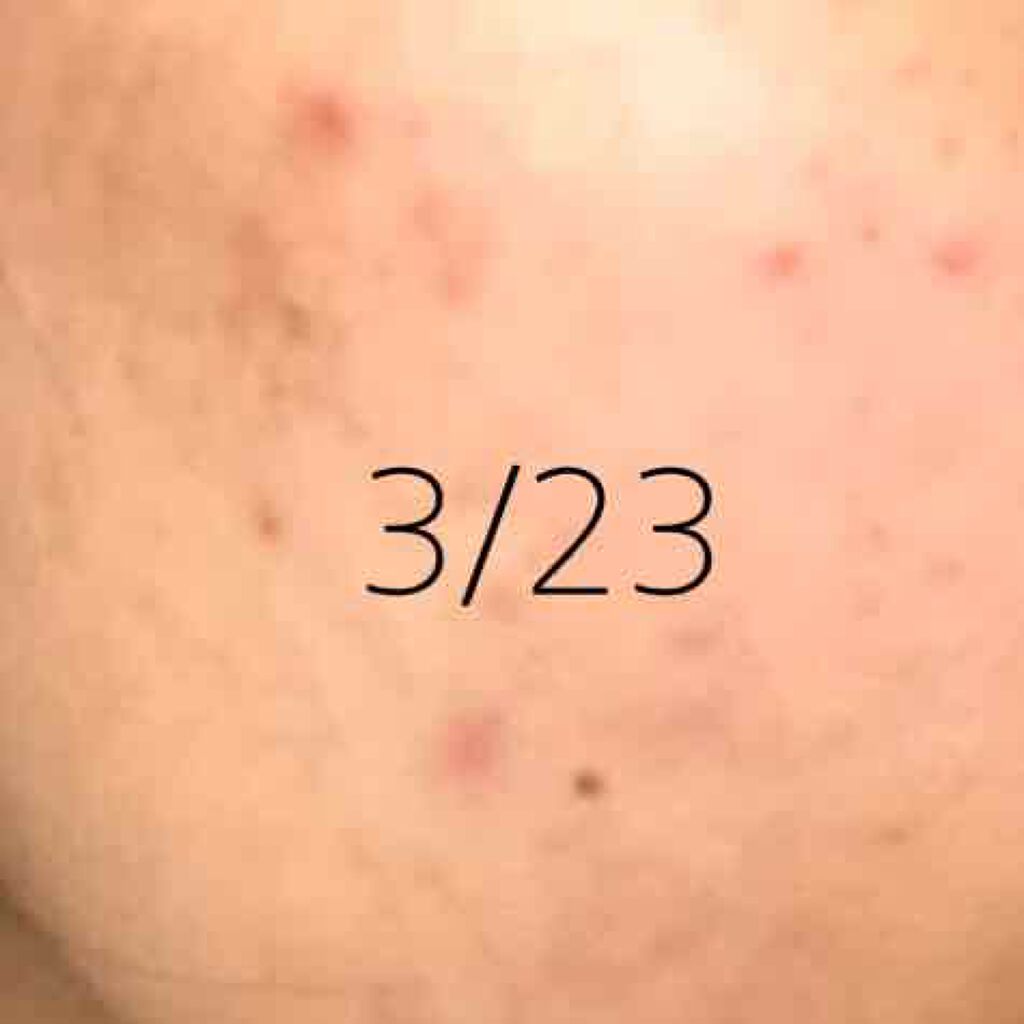 明色美顔水 薬用化粧水/美顔/化粧水を使ったクチコミ（2枚目）