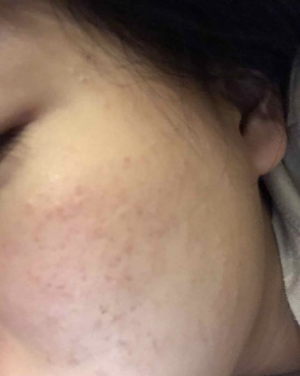 を使ったクチコミ(2枚目)