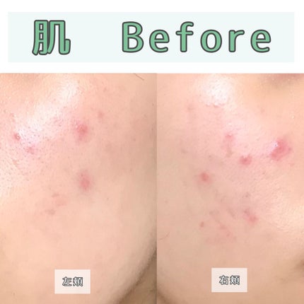 CICA デイリースージングマスク/VT/シートマスク・パックを使ったクチコミ(6枚目)