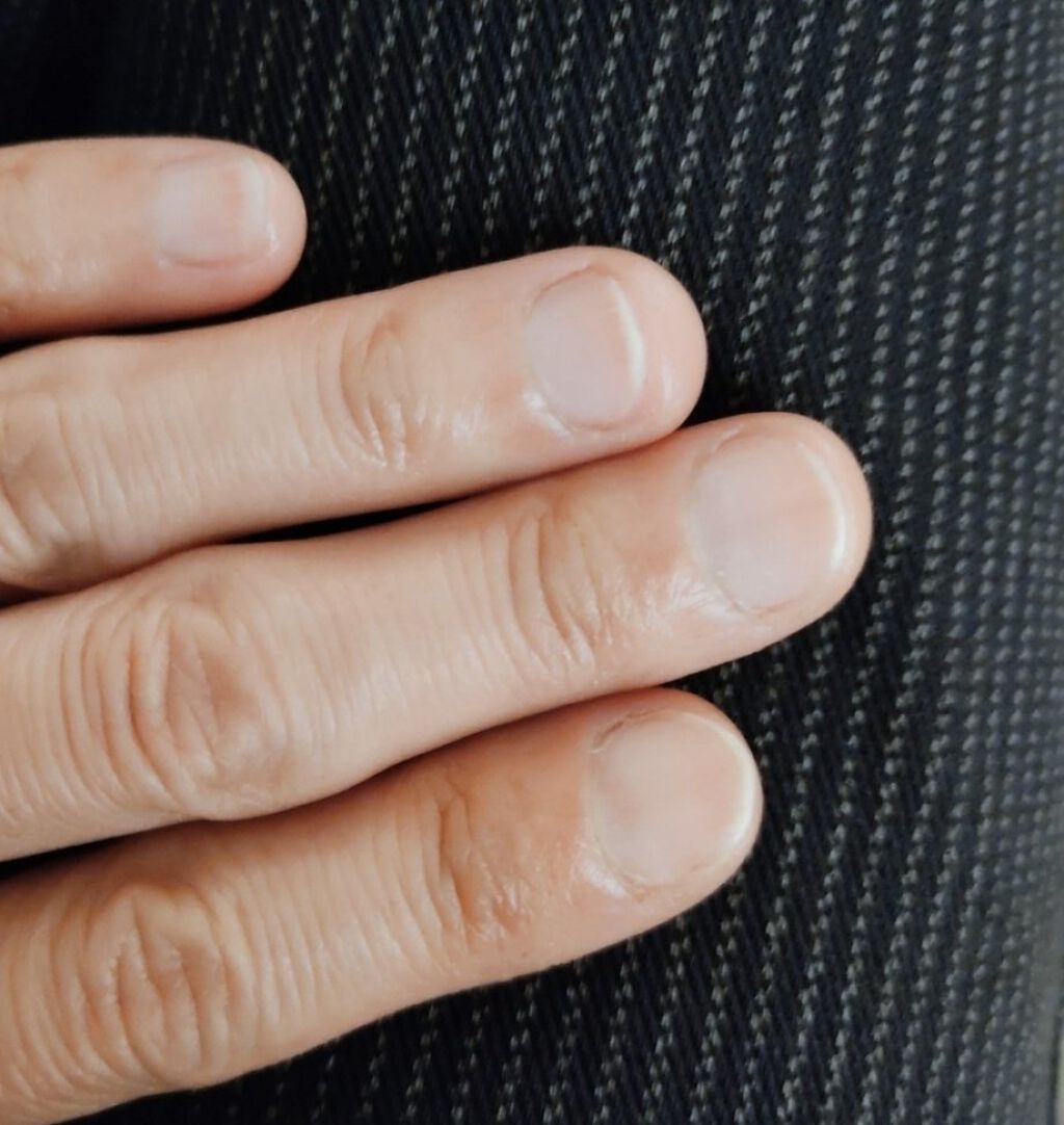 ネイルベッドオイル/アンドネイル/ネイルオイル・トリートメントを使ったクチコミ（1枚目）