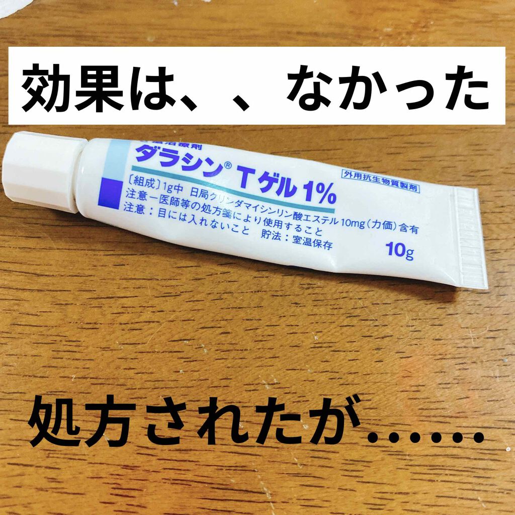 ダラシンTゲル 1% (医薬品)/佐藤製薬/その他を使ったクチコミ（1枚目）