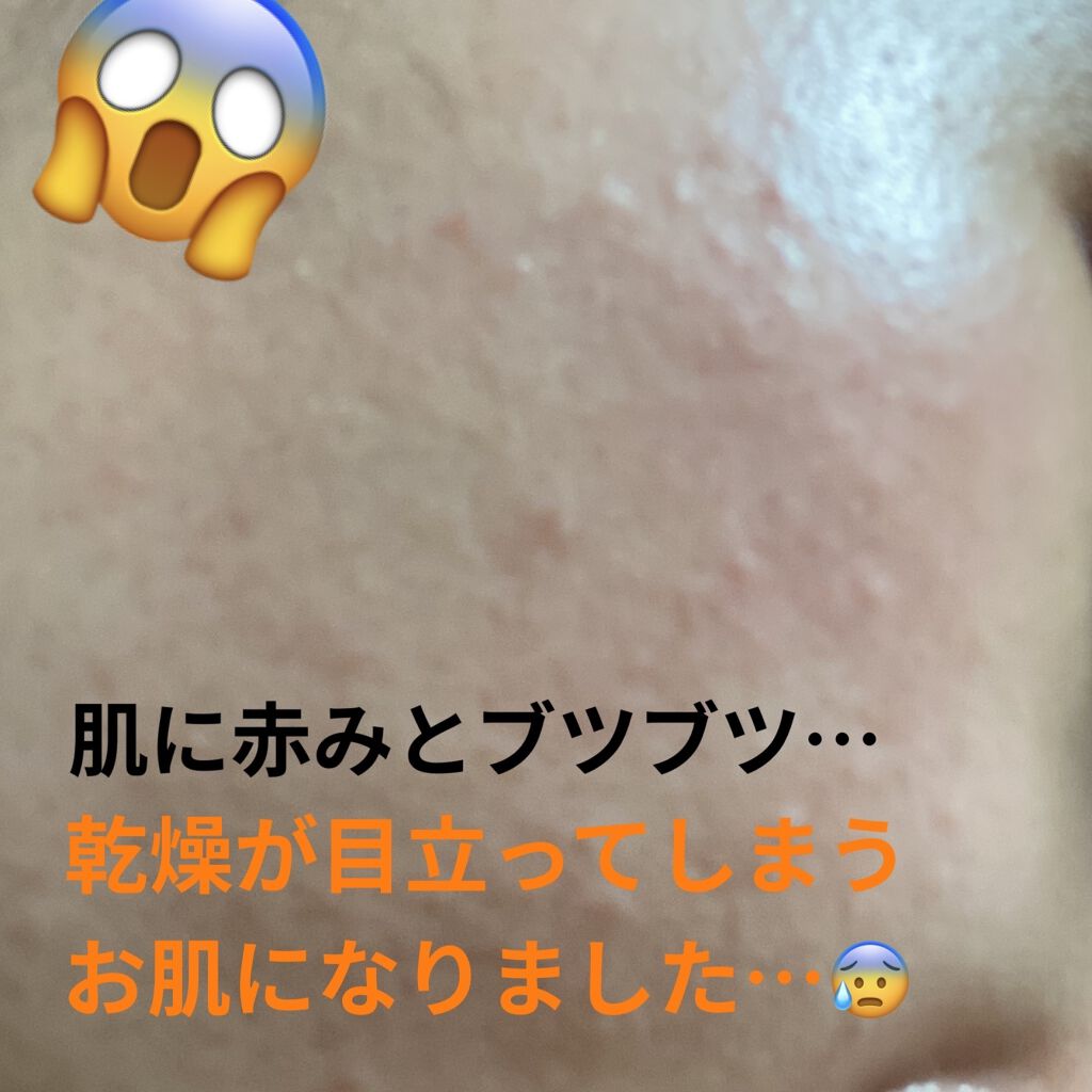 薬用しみ対策 美白化粧水/メラノCC/化粧水を使ったクチコミ（2枚目）