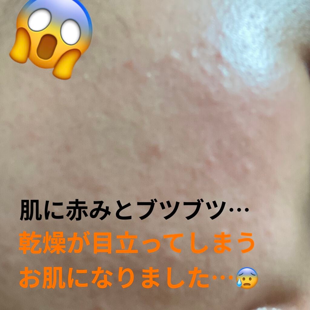 薬用しみ対策 美白化粧水/メラノCC/化粧水を使ったクチコミ(2枚目)