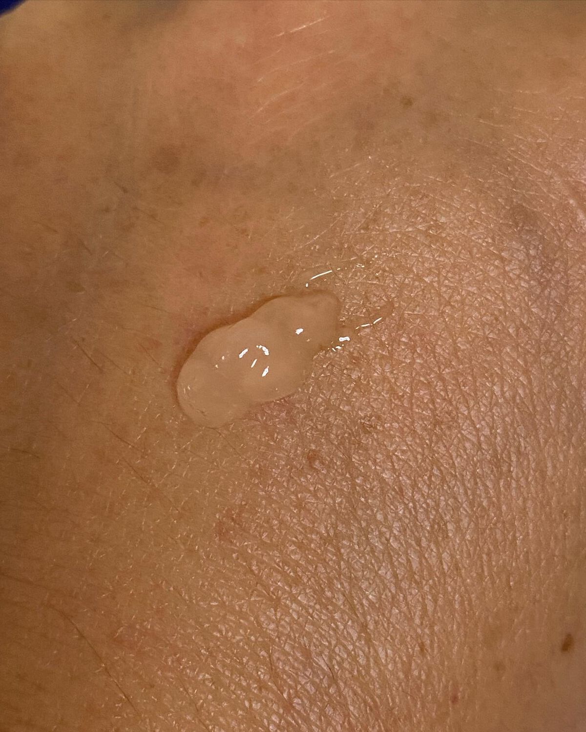 ピールショット/北の快適工房/ピーリングを使ったクチコミ(3枚目)