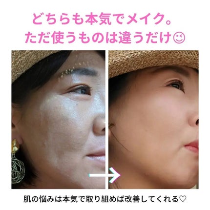 美肌カウンセラー💆肌悩みを解決し見る世界を変える on LIPS 「【自分をもっと好きになる♡スキンケア体験会スケジュールのお知ら..」(4枚目)