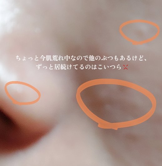 イポケアEX/ビーシーリンク/美容液を使ったクチコミ（2枚目）