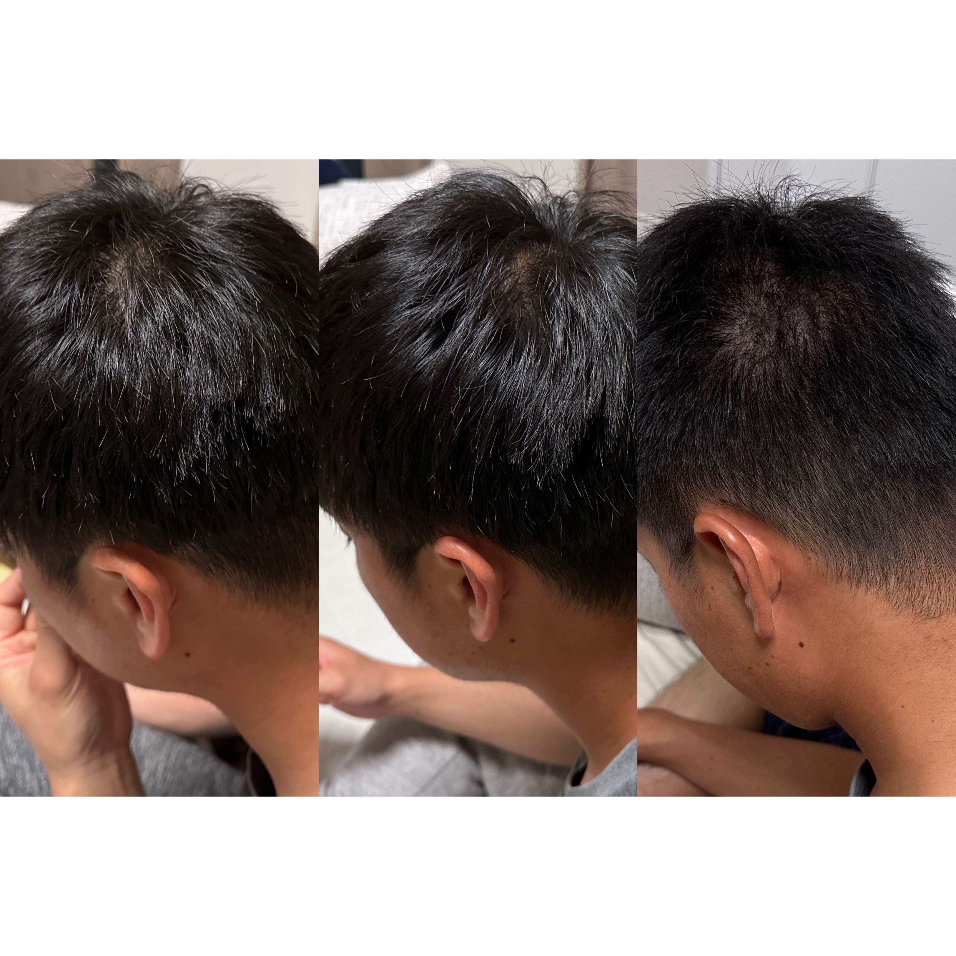 SonoRepro/アンファー(スカルプD)/ヘアケアグッズを使ったクチコミ（1枚目）