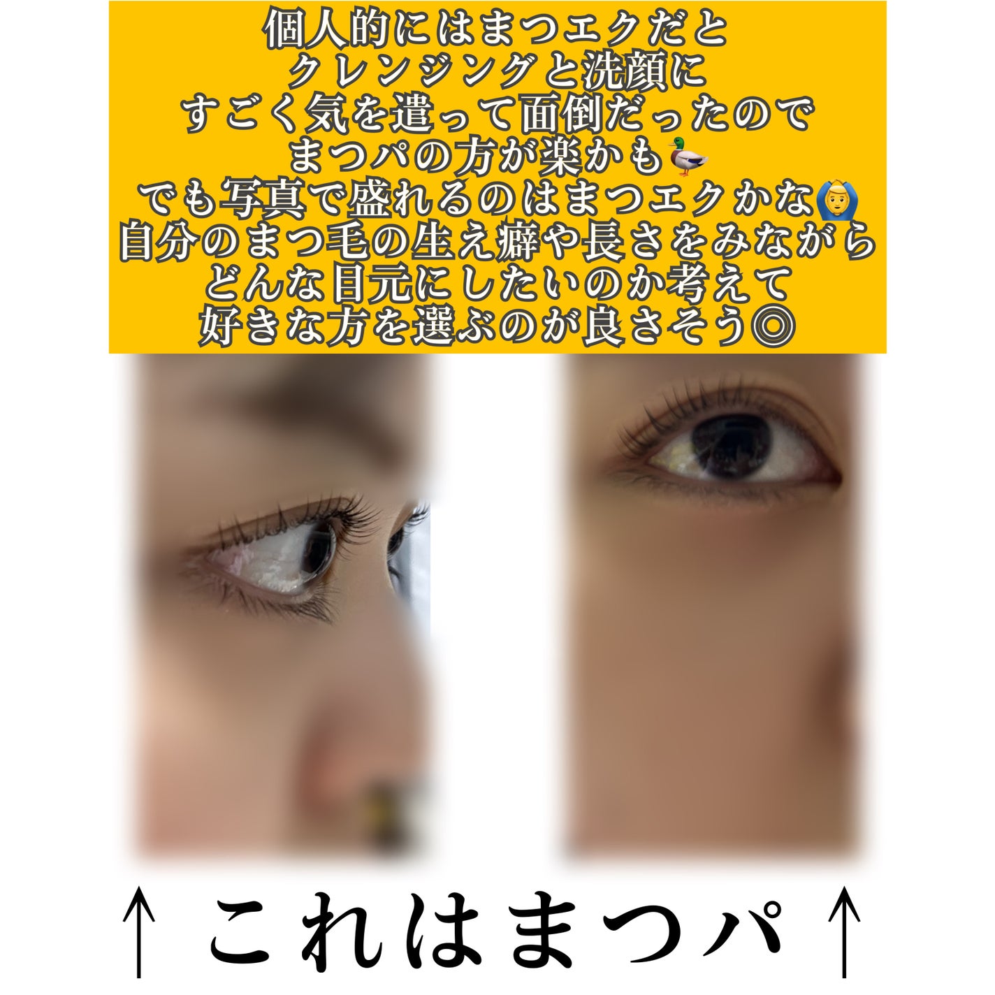 おんたま(フォロバ100) on LIPS 「まつパとまつエクの比較です!個人的には写真で盛れる▷まつエク好..」(7枚目)