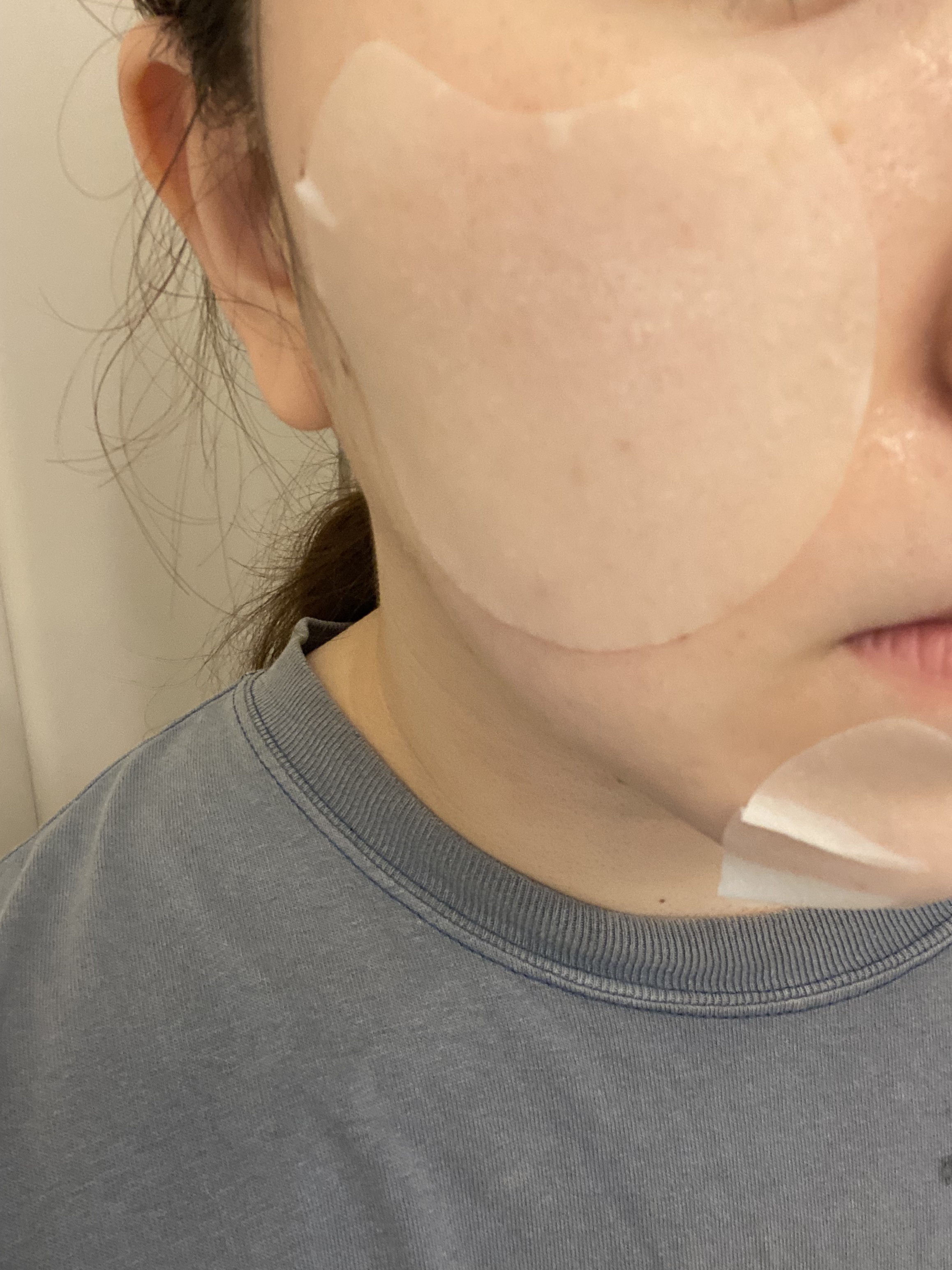 センテラ クイックカーミングパッド/SKIN1004/トナーパッドを使ったクチコミ（2枚目）