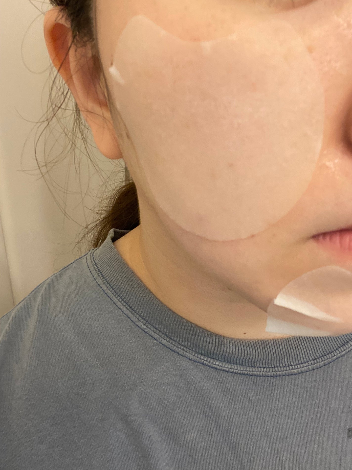 センテラ クイックカーミングパッド/SKIN1004/トナーパッドを使ったクチコミ(2枚目)