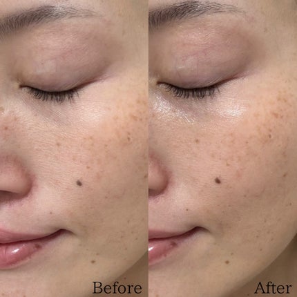 Ubihada エッセンス/Ubihada/化粧水を使ったクチコミ(4枚目)