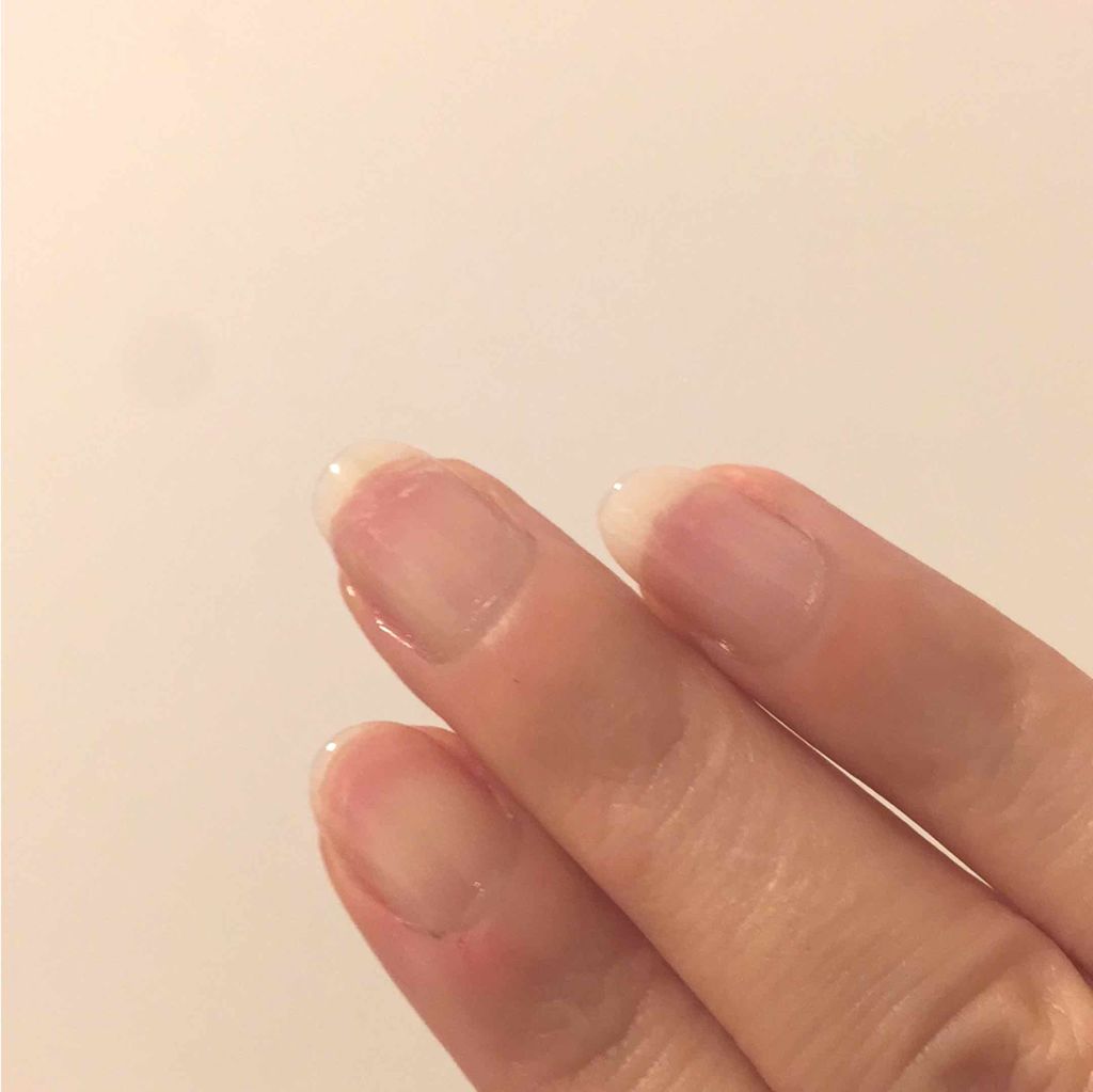 ネイルホリック ネイルホリック ベースコートのクチコミ「※※注意  3枚目 傷だらけ爪の写真です※※

ネイルシールを直貼りして爪が傷だらけに…
伸ば.....」（2枚目）