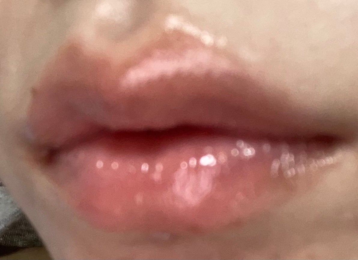 メンソレータム リップフォンデュ/メンソレータム/リップバームを使ったクチコミ(6枚目)