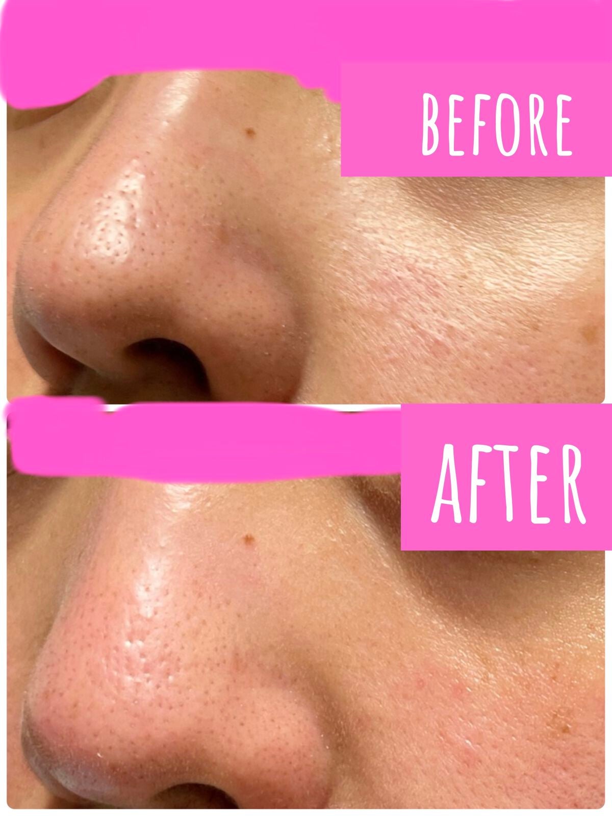 ツルリ ねっちり密着 スッキリはがすパック EX/ツルリ/シートマスク・パックを使ったクチコミ(4枚目)