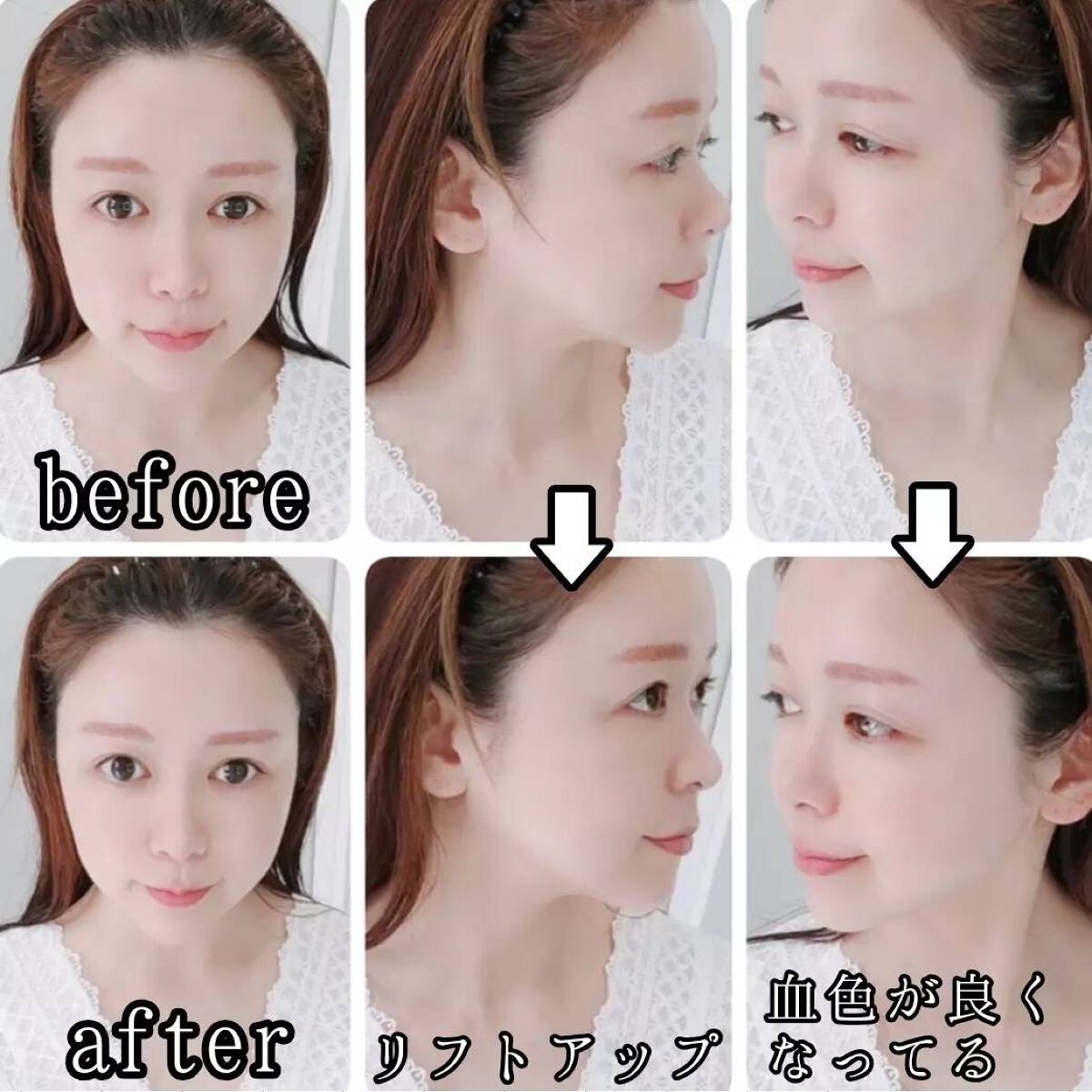 イオン導入美顔器フォトマックス /ar&ar /美顔器・マッサージを使ったクチコミ(3枚目)