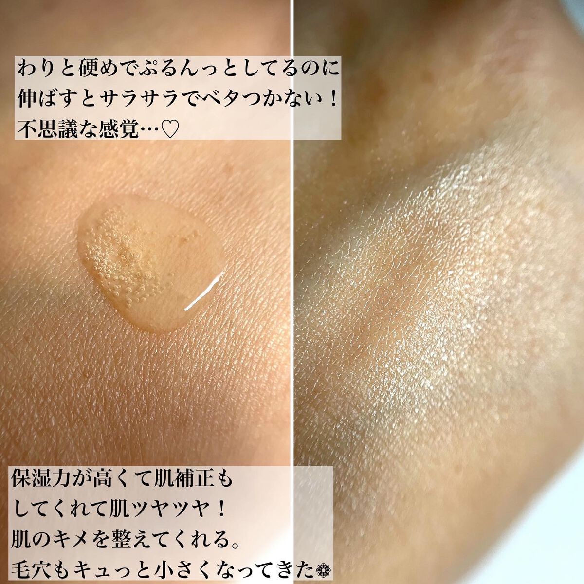 ビタペアC 集中美容液スペシャルセット/ネイチャーリパブリック/美容液を使ったクチコミ（3枚目）