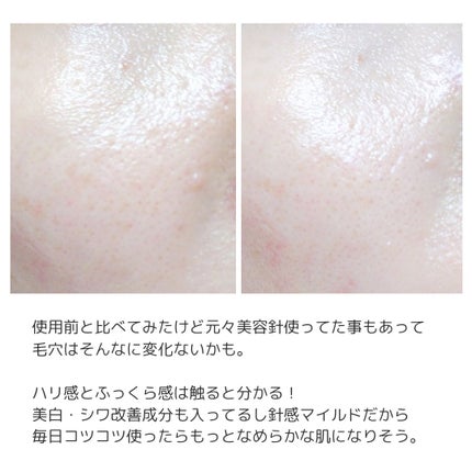 パンテショット675/COSNORI/美容液を使ったクチコミ(2枚目)