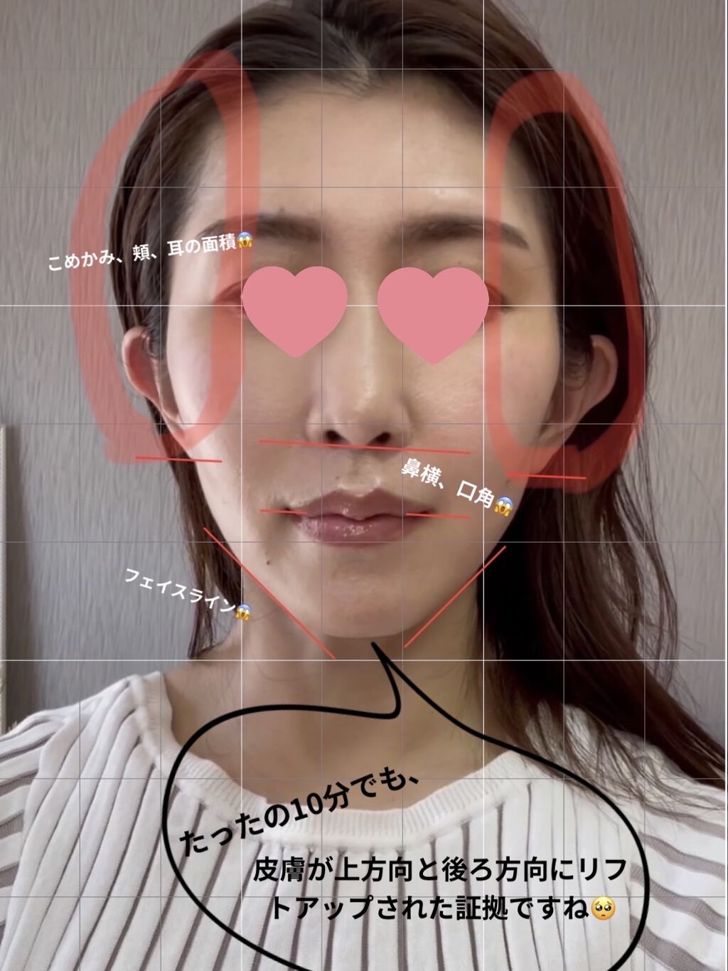 デンキバリブラシ®/ELECTRON/美顔器・マッサージを使ったクチコミ（3枚目）