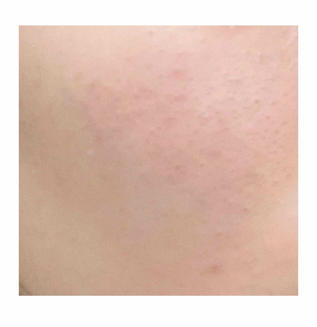 お米のパック/毛穴撫子/洗い流すパック・マスクを使ったクチコミ（3枚目）