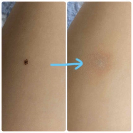 スポッツカバー ファウンデイション/SHISEIDO/クリームコンシーラーを使ったクチコミ(3枚目)