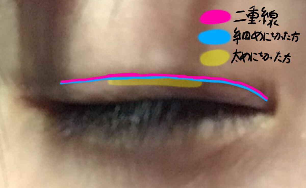 肌色タイプ/バンドエイド/その他を使ったクチコミ（1枚目）