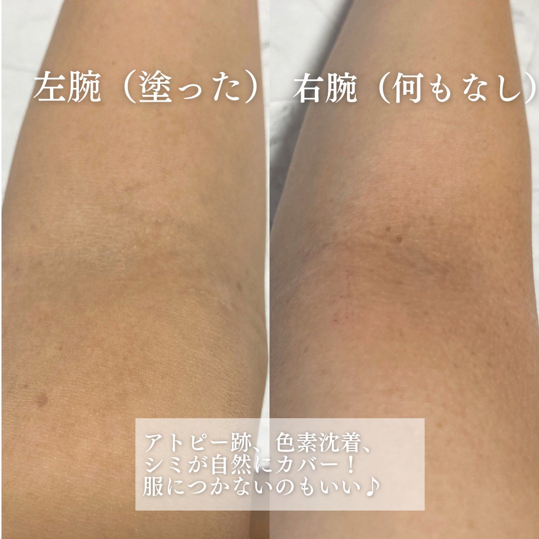 マーシュフィールド SC ボディカバーファンデN/マーシュ・フィールド/クリーム・エマルジョンファンデーションを使ったクチコミ(6枚目)