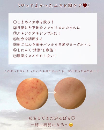 ミネラルコンシーラー/エトヴォス/スティックコンシーラーを使ったクチコミ(9枚目)