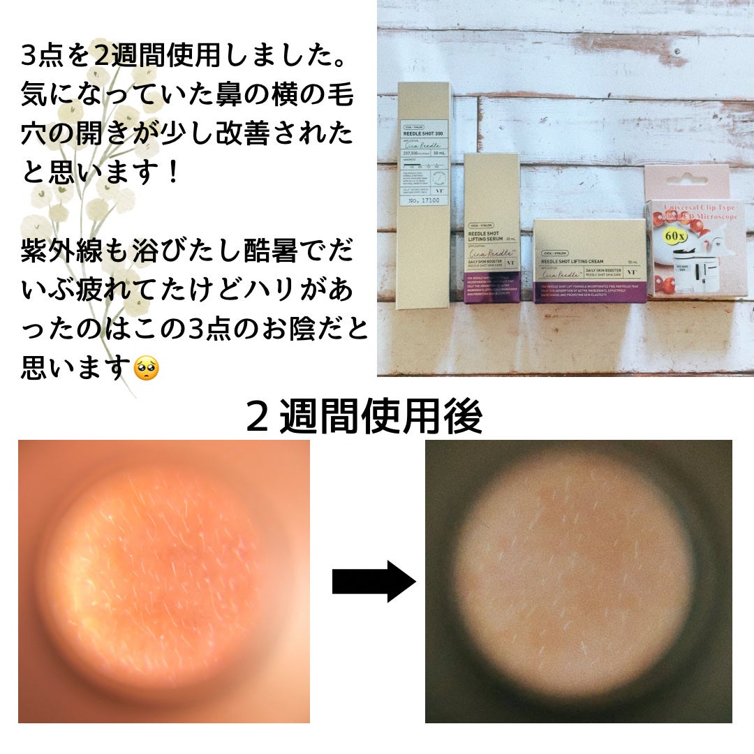 リードルショット300/VT/美容液を使ったクチコミ(5枚目)