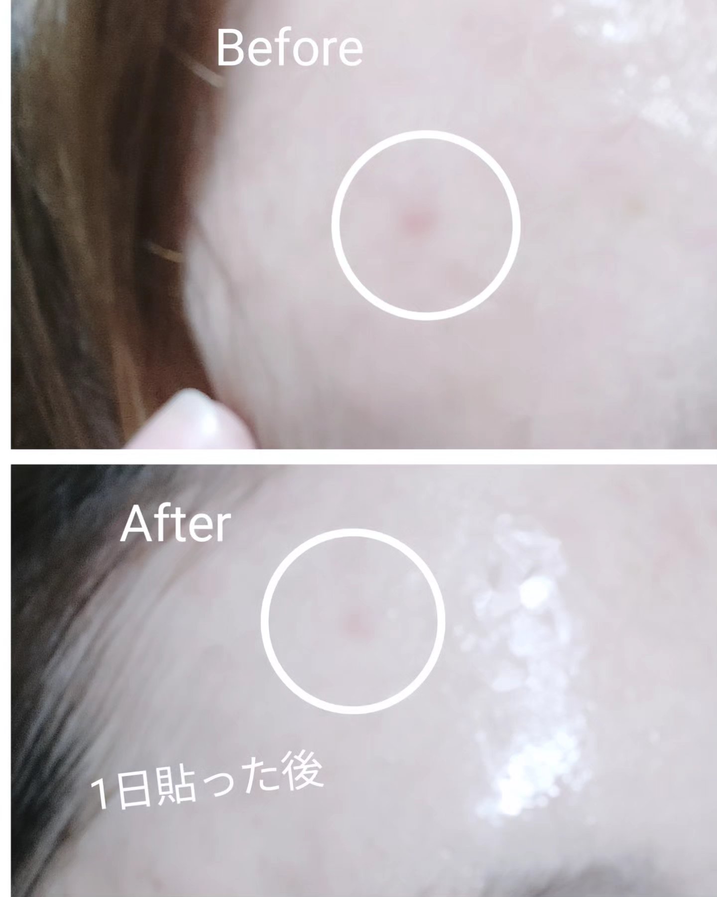 FATION ノスカナイン スポット パッチのクチコミ「♚FATION ノスカナイン スポット パッチ♚

‎‪𓍯 ‬10mm×8枚、12mm×15枚.....」（3枚目）