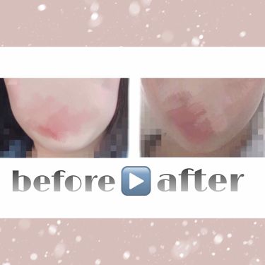 かっさプレート Daisoの口コミ こんばんは 今回は顔痩せ方法ご紹介します By M 代前半 Lips