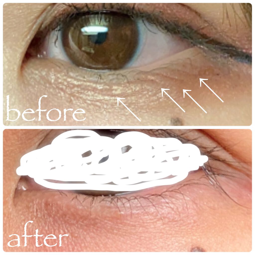 アイプラスクリーム/DEWYCEL/アイケア・アイクリームを使ったクチコミ（3枚目）