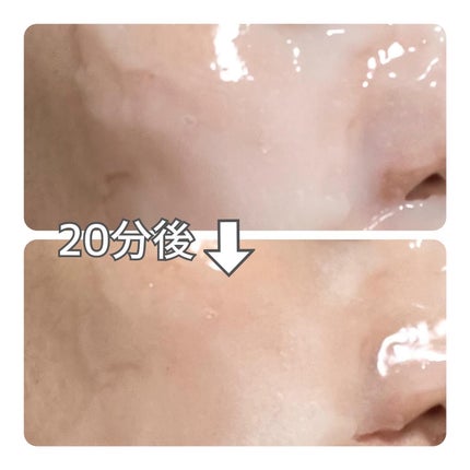 モイストリッチ炭酸パック/セルロジーコスメ/シートマスク・パックを使ったクチコミ(6枚目)