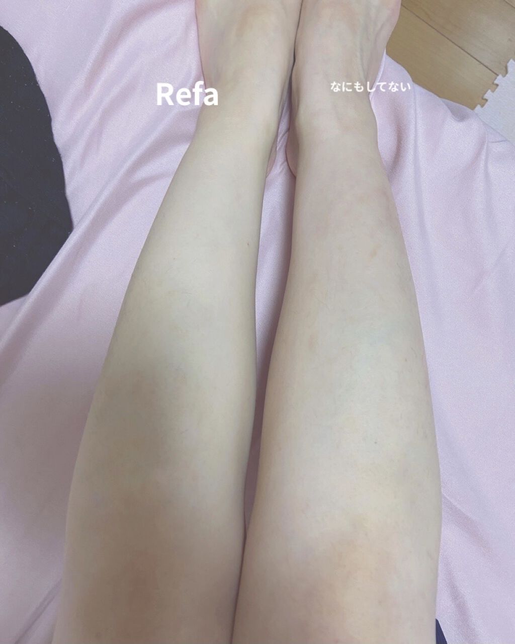 ReFa CARAT/ReFa/ボディケア美容家電を使ったクチコミ（1枚目）