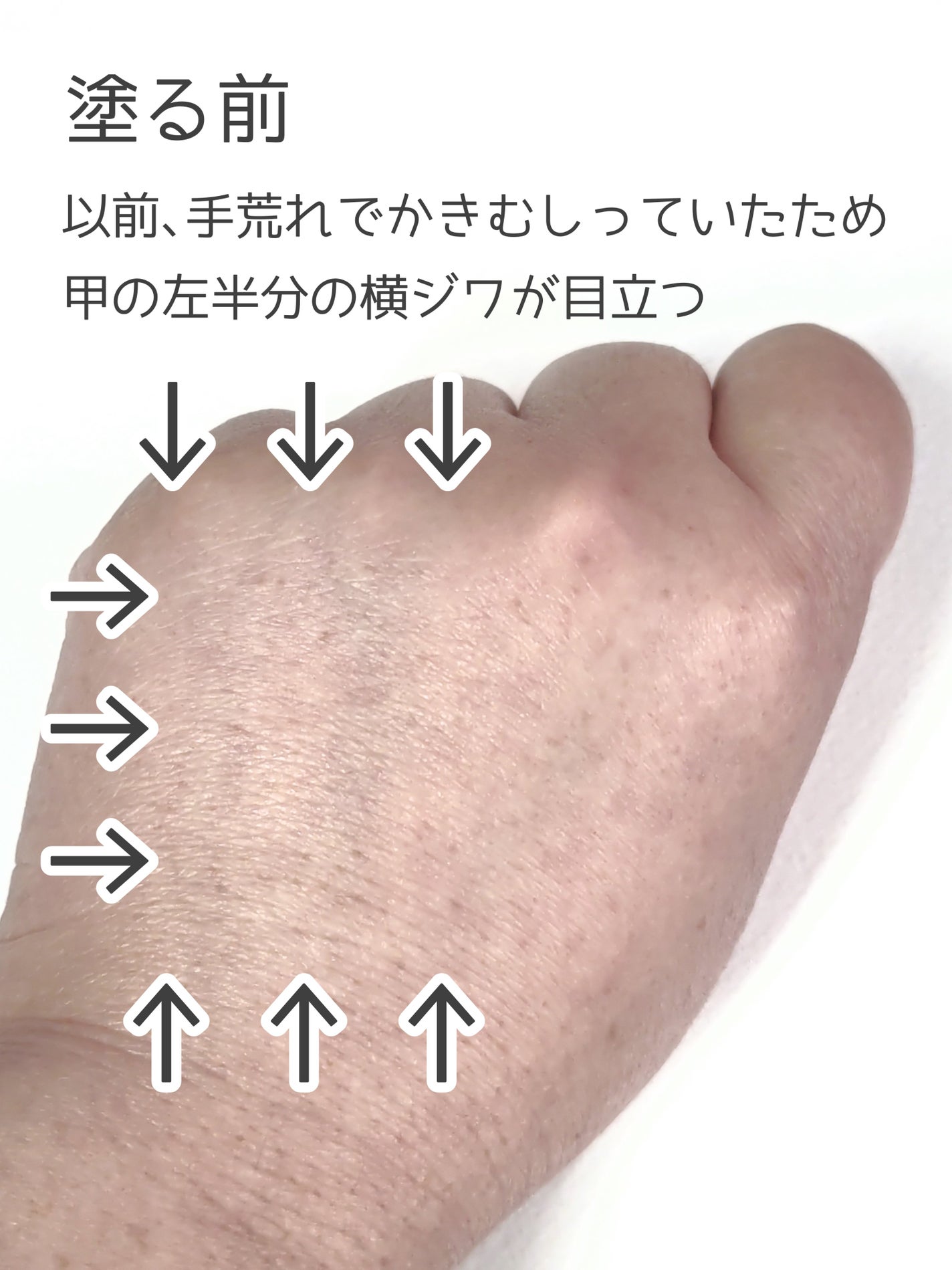 リンクル ダブル リペア/ONE BY KOSE/美容液を使ったクチコミ(5枚目)