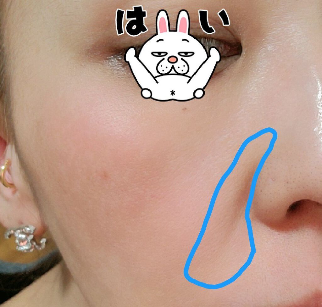 メディリフト 3Dマイクロフィラー(口元用)/YA-MAN TOKYO JAPAN/シートマスク・パックを使ったクチコミ（2枚目）