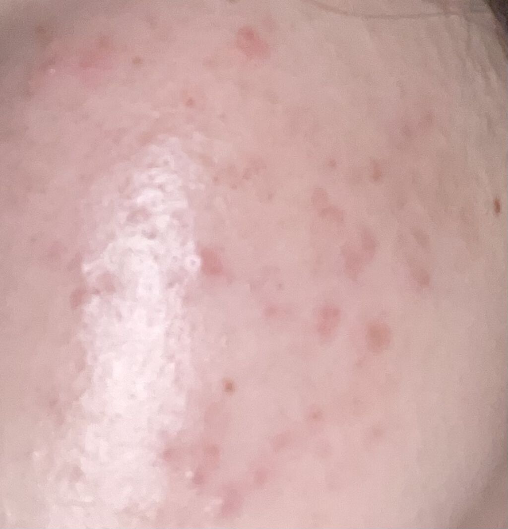 キレートレモン/Pokka Sapporo (ポッカサッポロ)/美容ドリンクを使ったクチコミ（1枚目）