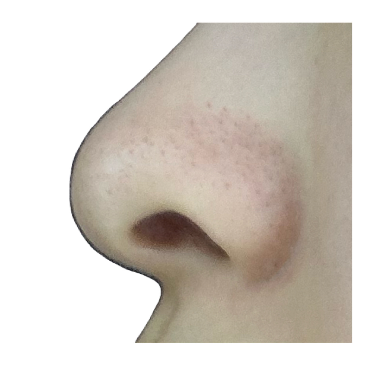 ノーモアブラックヘッド(ノーズピーリング)/One-day's you/スクラブ・ゴマージュを使ったクチコミ（3枚目）