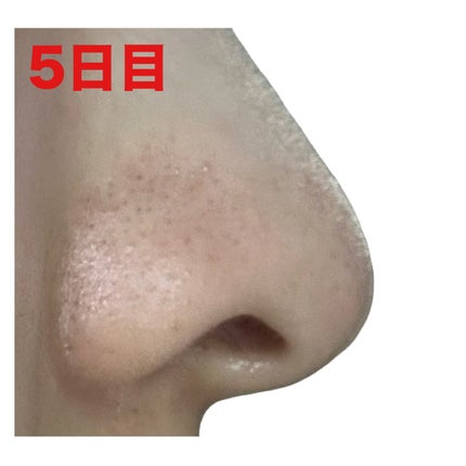 泥ジェル洗顔/ファンケル/その他洗顔料を使ったクチコミ(8枚目)