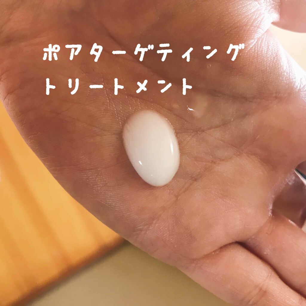 薬用3ステップセット30日サイズ/プロアクティブ/トライアルキットを使ったクチコミ(2枚目)