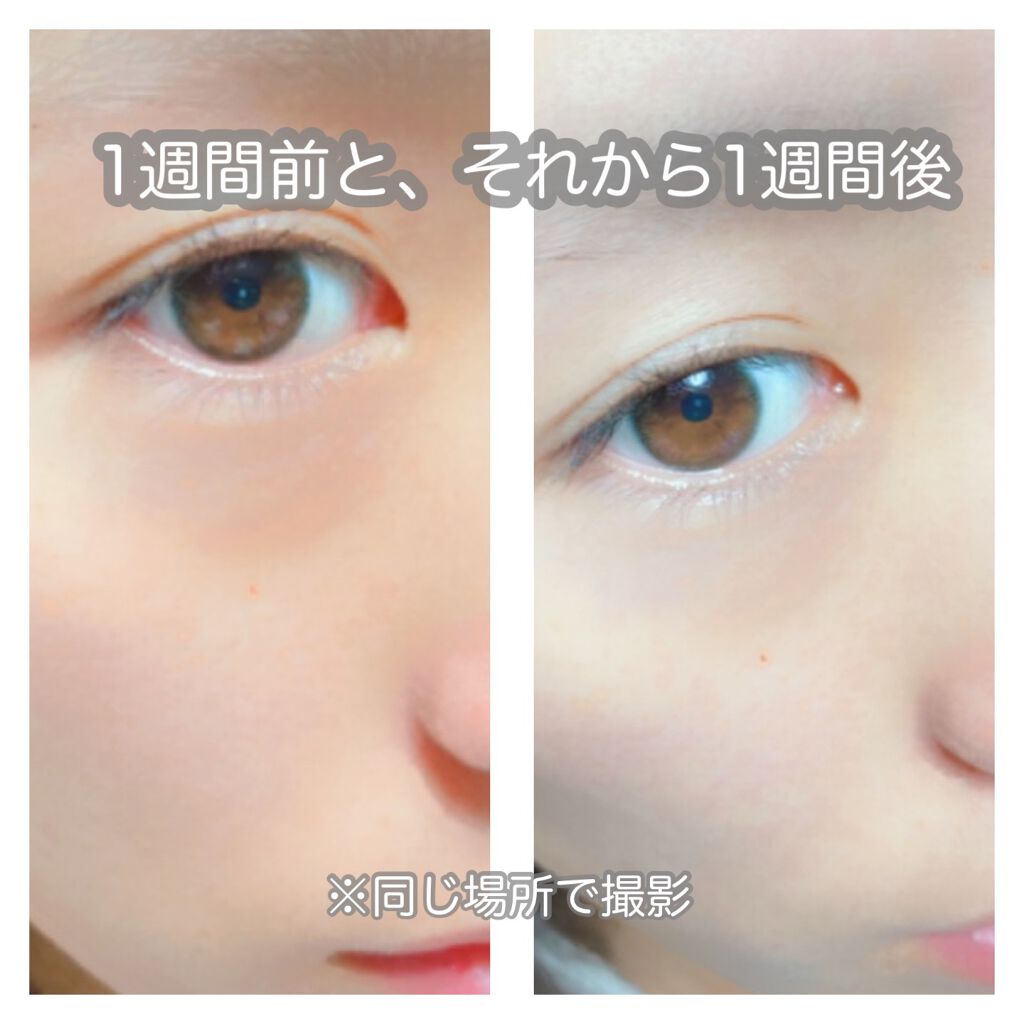 パーフェクトホワイトクレイ/SENKA(専科)/洗顔フォームを使ったクチコミ(2枚目)