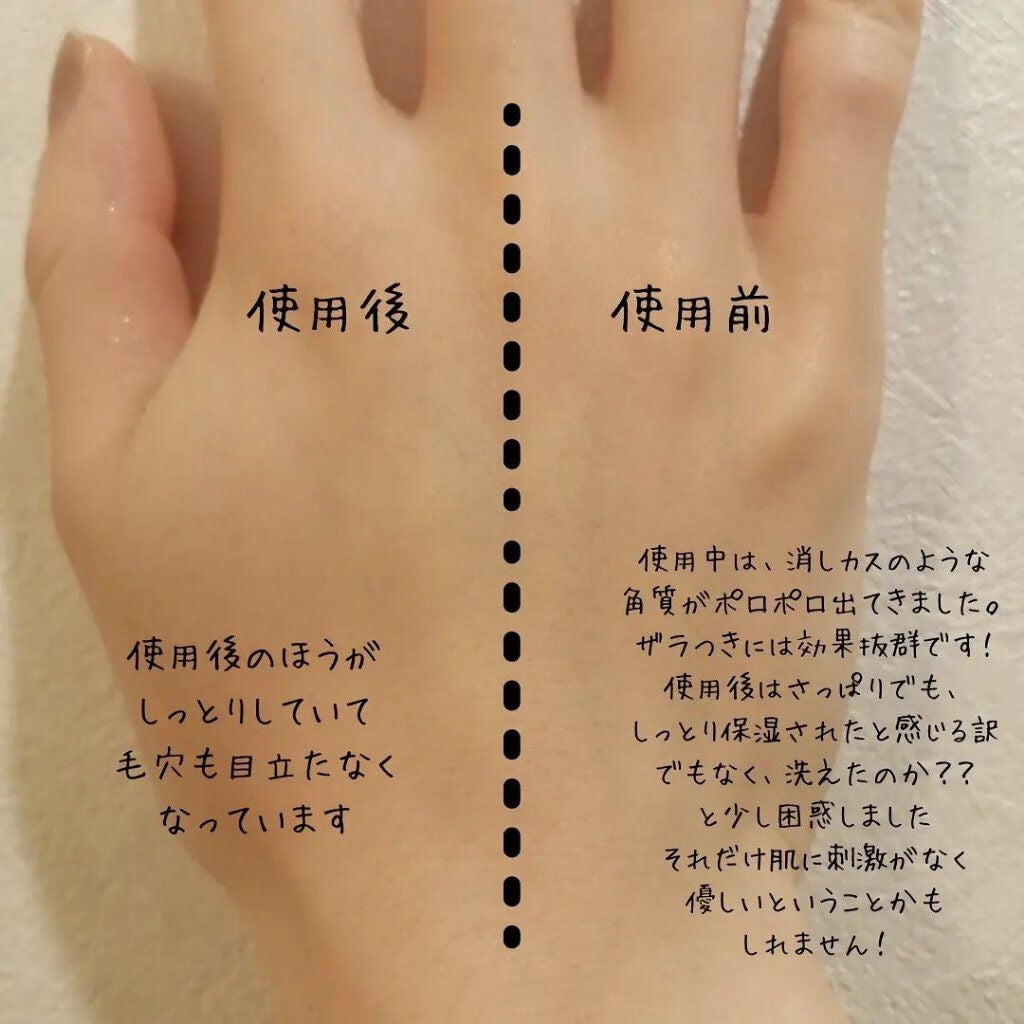 DETクリア ブライト&ピール ピーリングジェリー 炭/Detclear/ピーリングを使ったクチコミ(3枚目)