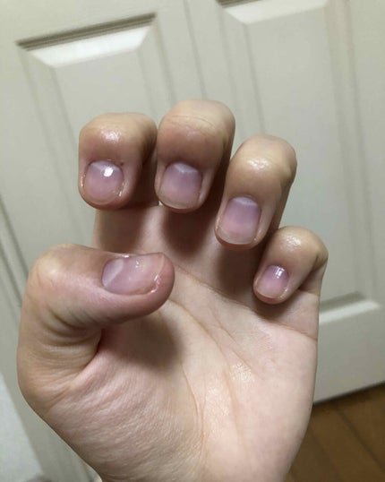 ネイルベッドオイル/アンドネイル/ネイルオイル・トリートメントを使ったクチコミ(1枚目)