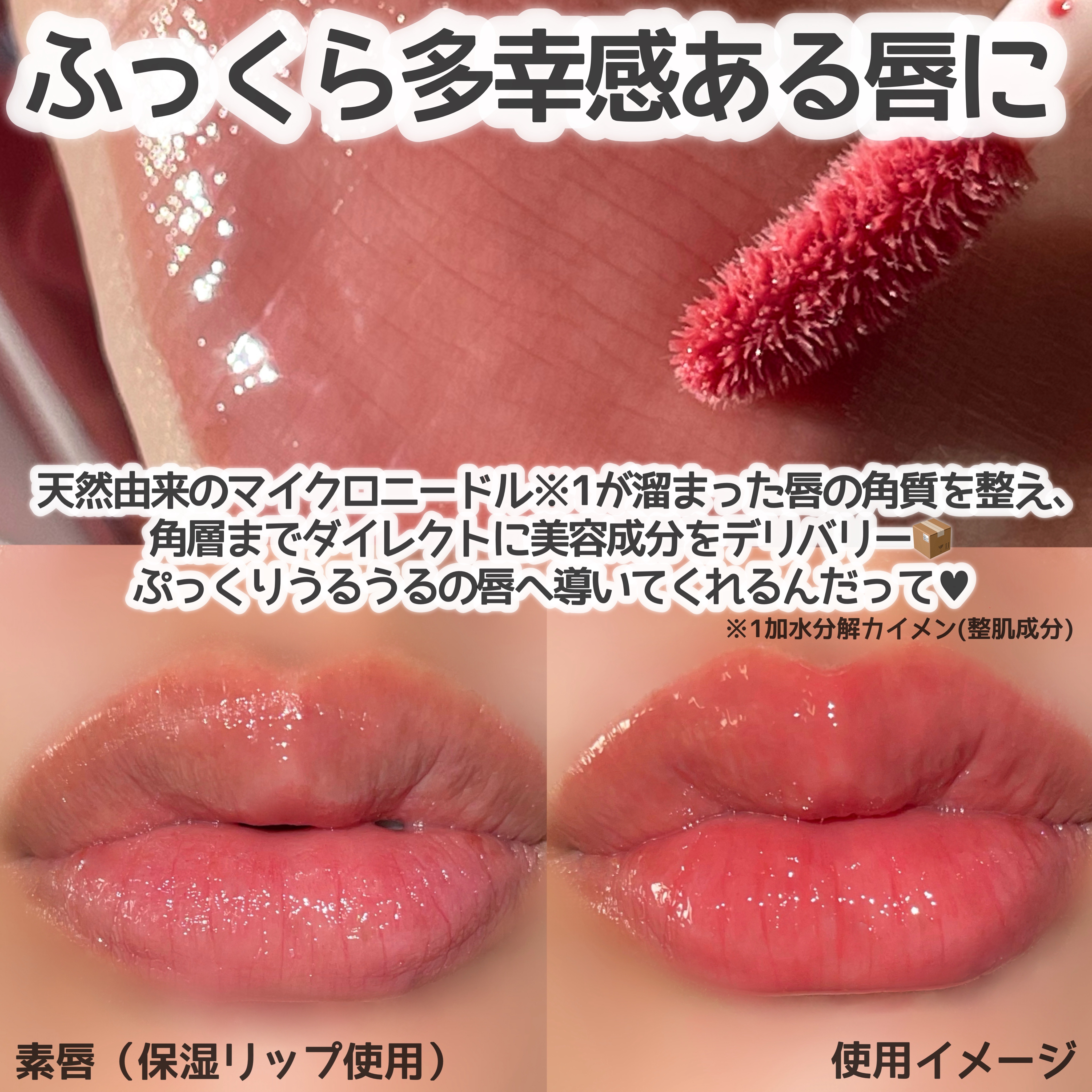 ニードルプランパー 高熱フィグ/Ui2./リッププランパーを使ったクチコミ（2枚目）