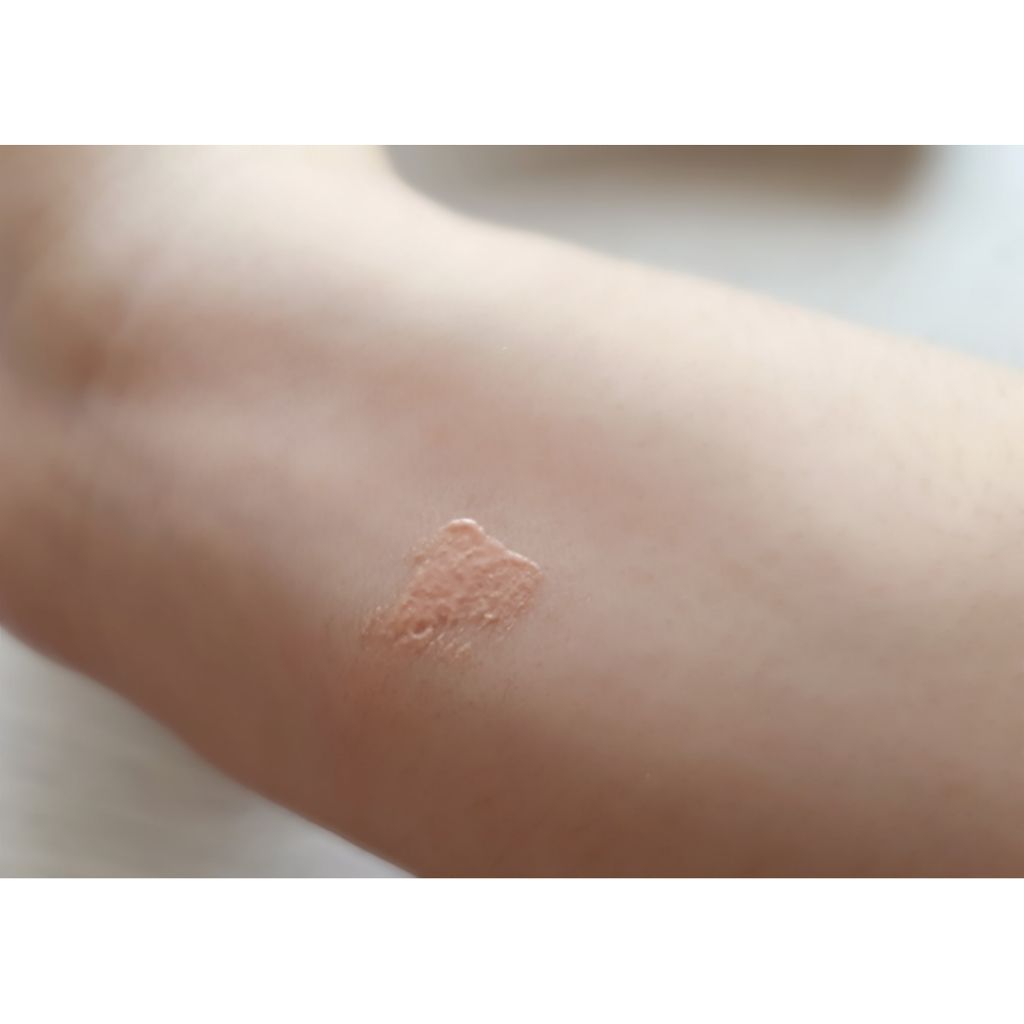 ニキビ治療薬クリーム (医薬品)/クレアラシル/その他を使ったクチコミ(3枚目)