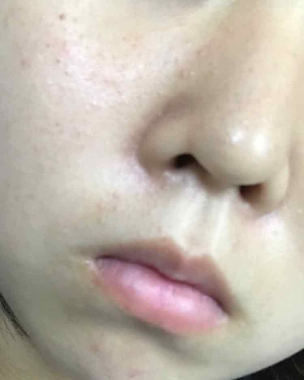 ハトムギ化粧水(ナチュリエ スキンコンディショナー R )/ナチュリエ/化粧水を使ったクチコミ（3枚目）