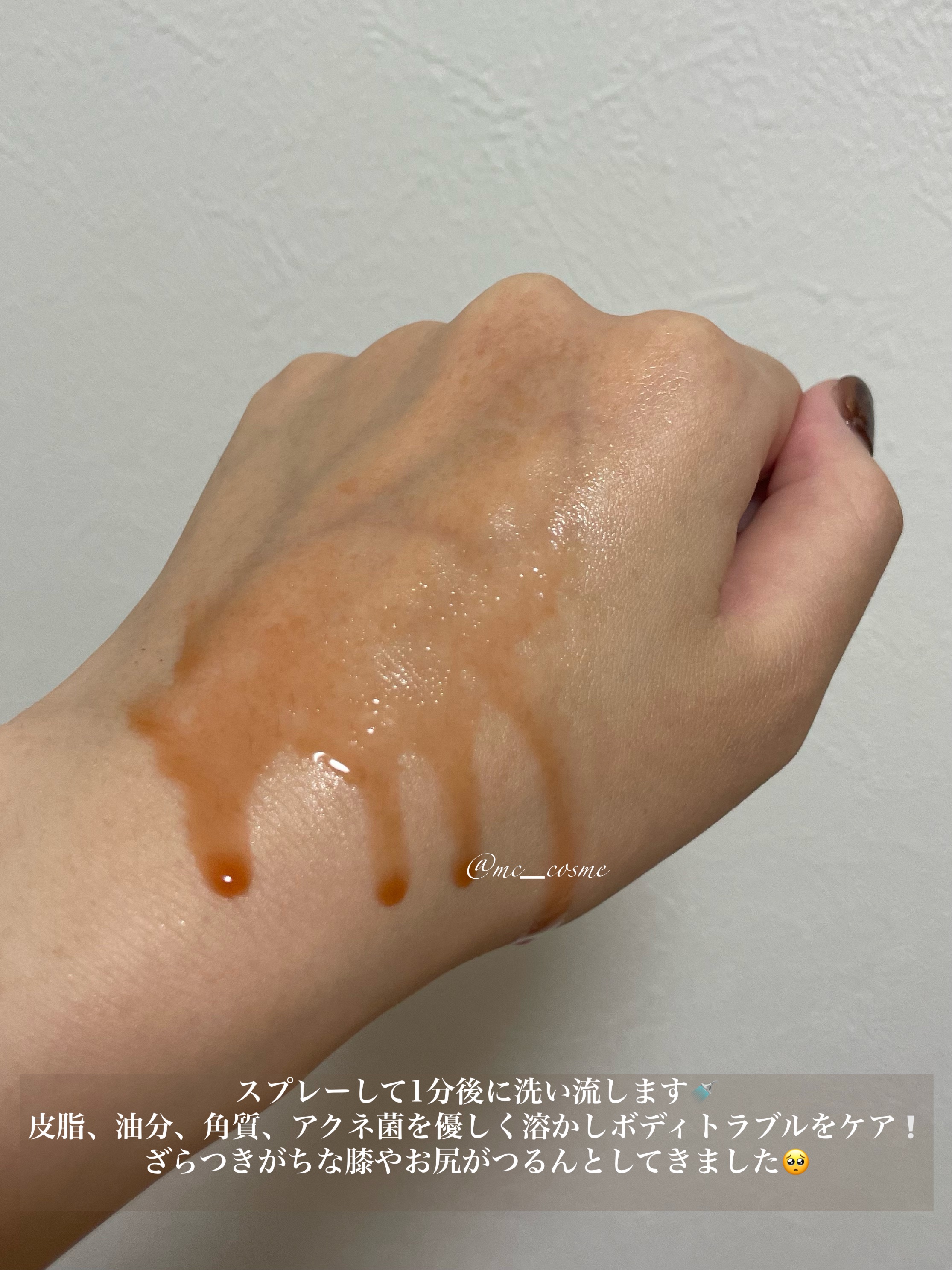 レッドアクネ ボディピーリングショット/MEDICUBE/ピーリングを使ったクチコミ（2枚目）