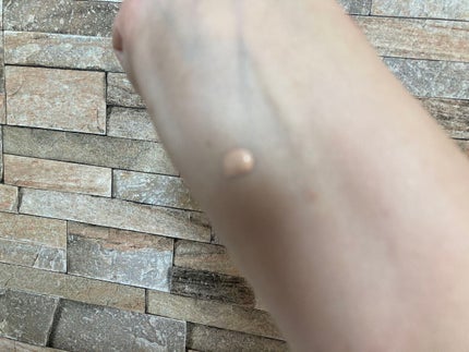 リキッドコンシーラー/Kirei&co./リキッドコンシーラーを使ったクチコミ(3枚目)