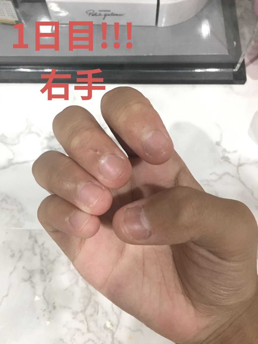 を使ったクチコミ（1枚目）