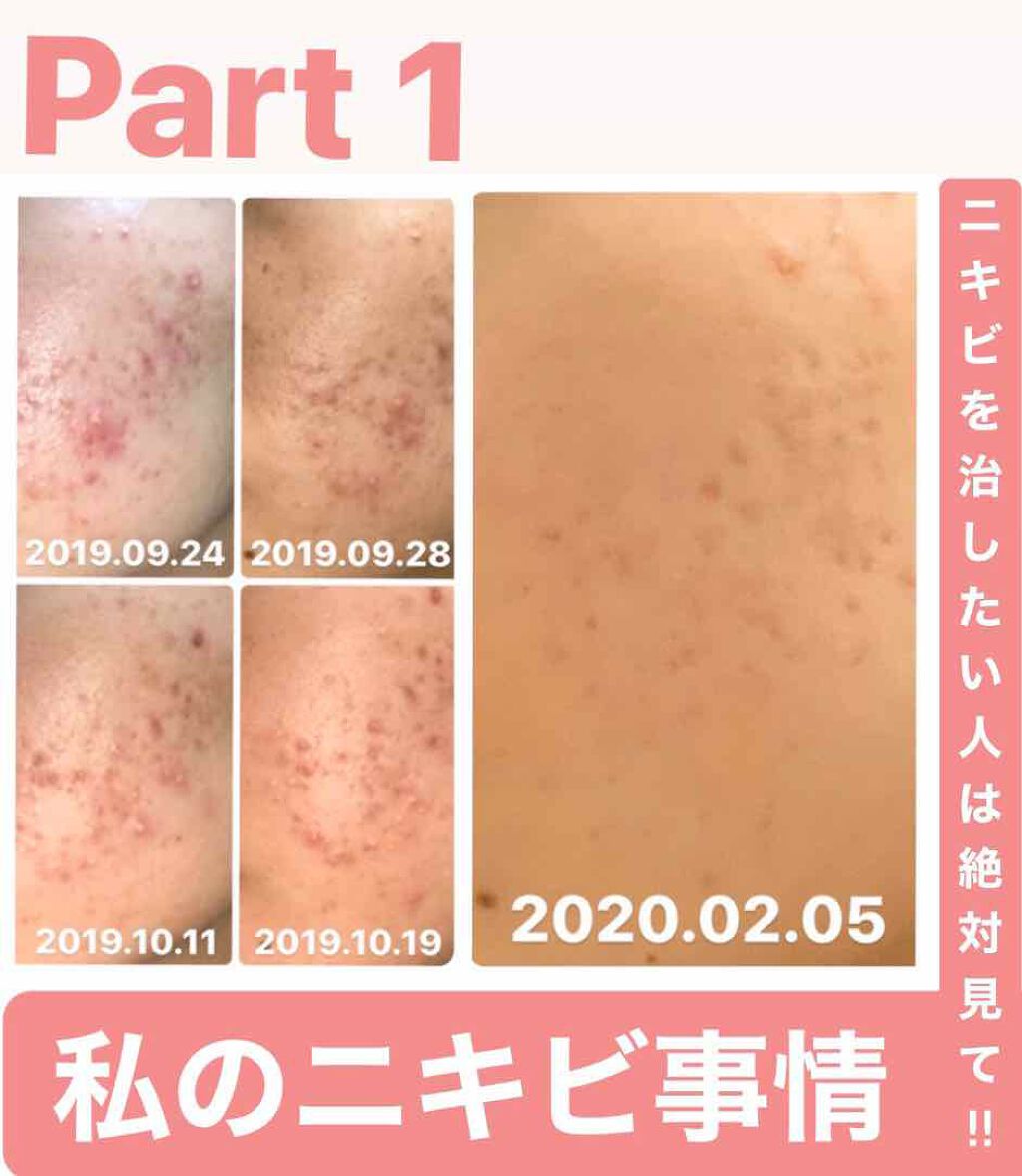 いちごあめ🍓 on LIPS 「こんにちは☺︎いちごあめ🍓です‼︎初投稿です😅酷すぎる私のニキ..」(1枚目)